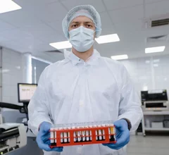 DNA analysis