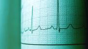 Electrocardiograms analyzed by AI can offer information about mortality risk.