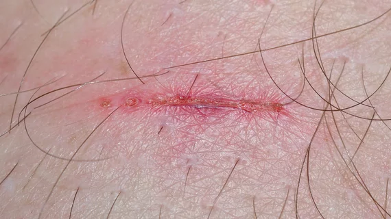 wound_scar.jpg