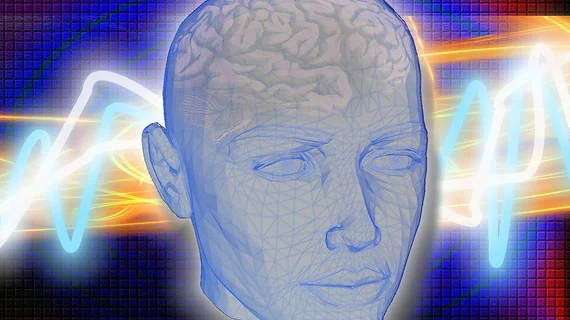 epilepsy_seizure_brain.jpg