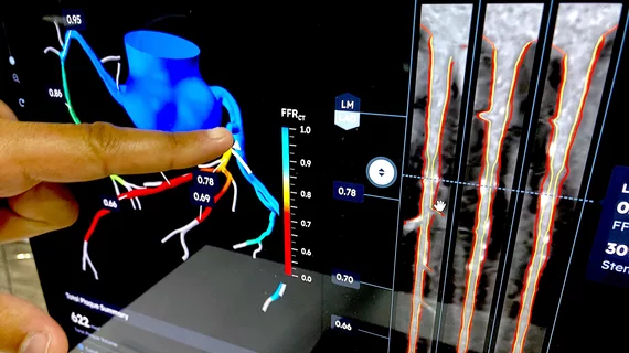 HeartFlow FFR-CT and Plaque Analysis AI software demo at TCT 2024. DF