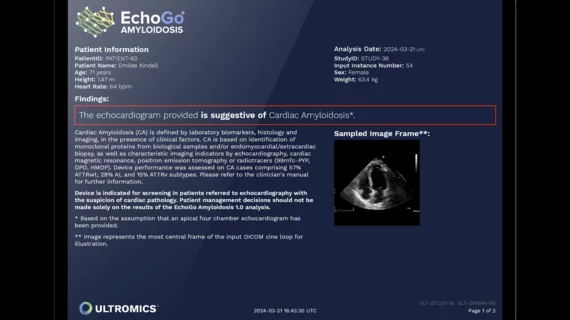 Ultromics EchoGo Amyloidosis artificial intelligence. A first of its kind AI model developed by Mayo Clinic and Ultromics Ltd., was found to be highly accurate in screening for cardiac amyloidosis in a large 2,612 patient clinical trial. The findings were published in the European Heart Journal.[1] Mayo Clinic, investigators at the University of Chicago Medicine and collaborators around the world at other sites, validated and tested the model on a large and multi-ethnic population.