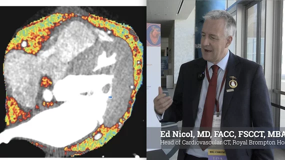 Ed Nicol, MD, FACC, FSCCT, MBA, FRCP, FRCR, FRAeS, head of cardiovascular CT, Royal Brompton Hospital, London, United Kingdom, and former president of the Society of Cardiovascular Computed Tomography (SCCT), explains some of the new technologies being developed to expand cardiac CT as a diagnostic tool.